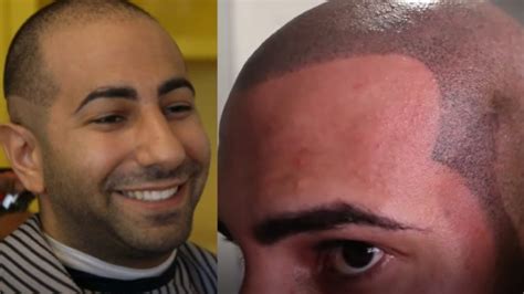 fousey with hair